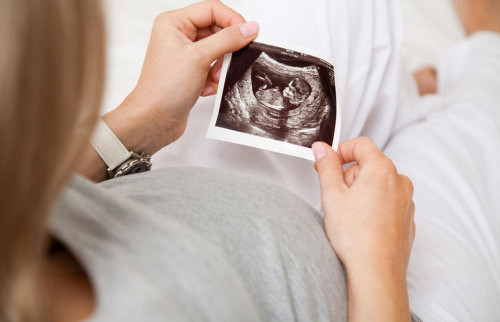 اتىراۋلىق ايەل جۇكتىلىگىن دارىگەردەن جاسىرىپ كەلگەن