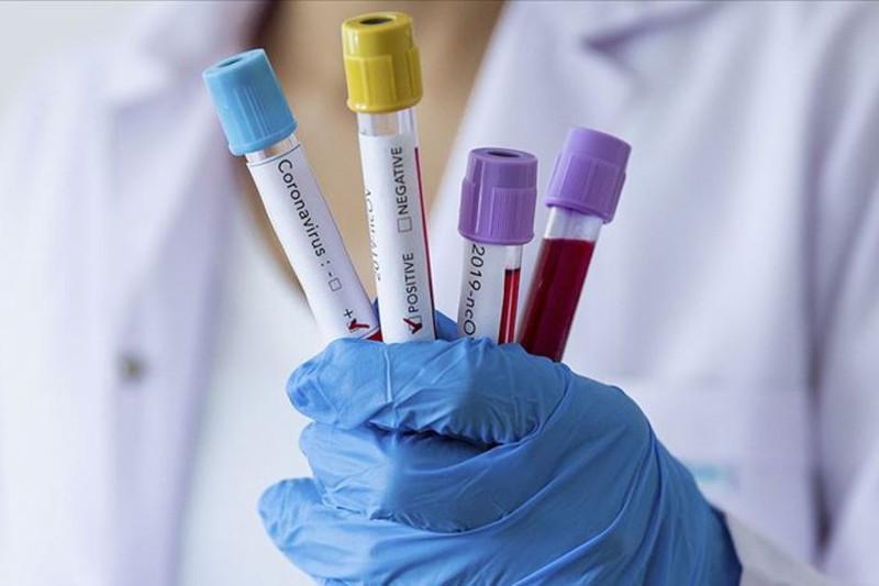 كوروناۆيرۋس: الماتىدا ءبىر تاۋلىكتە 293 ناۋقاس انىقتالدى