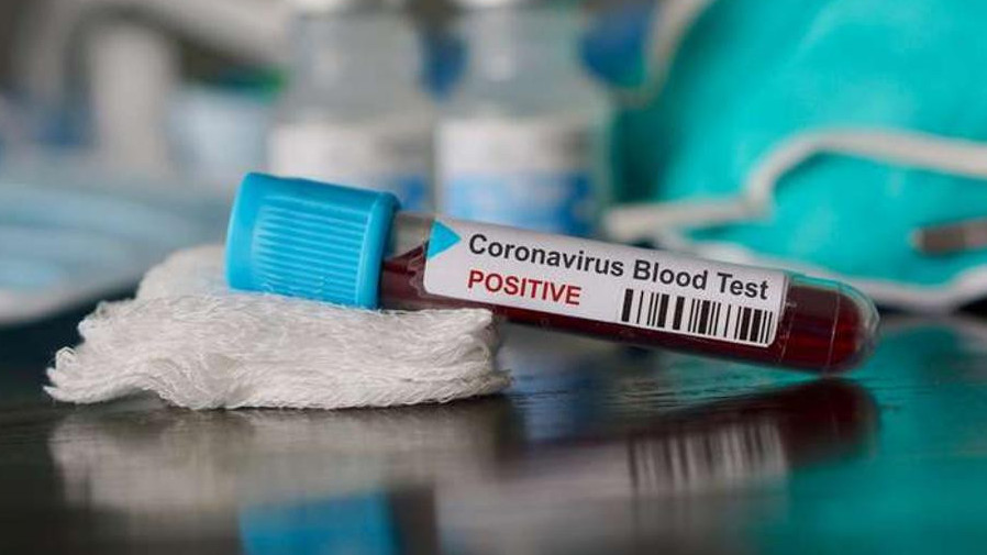 اتىراۋدا كوروناۆيرۋسقا شالدىققاندار سانى 48 ادامعا كوبەيدى