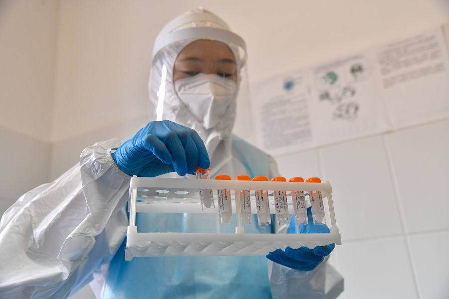 COVID-19-دان كەيىنگى اسقىنۋلار تالقىلاندى