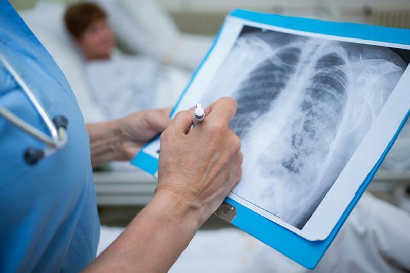 پنەۆمونيادان 3 ادام قايتىس بولدى