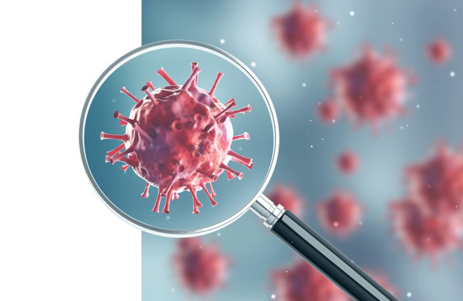 كوروناۆيرۋسپەن جاپپاي كۇرەسۋ – پارىز