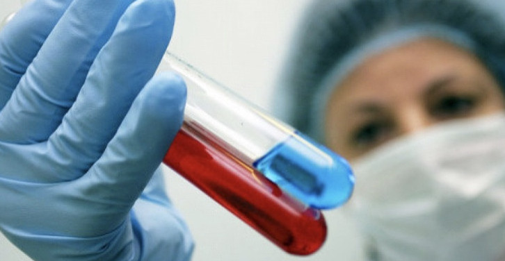 الماتىدا ايتۆ-نى توقتاتۋدىڭ جاڭا ءادىسى ەنگىزىلدى