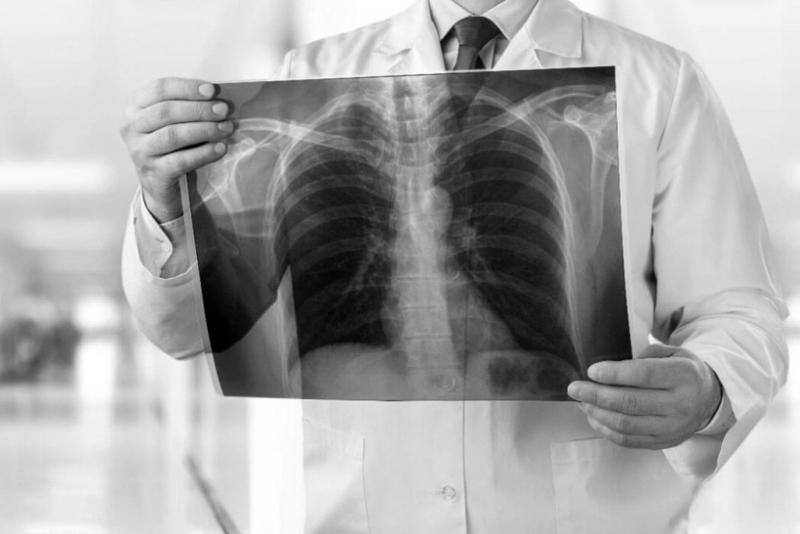 كوروناۆيرۋس پنەۆمونياسىنان 7 ادام قايتىس بولدى