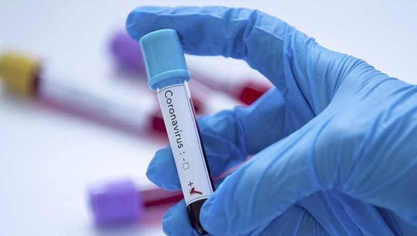 كوروناۆيرۋس قايتا كۇشەيدى