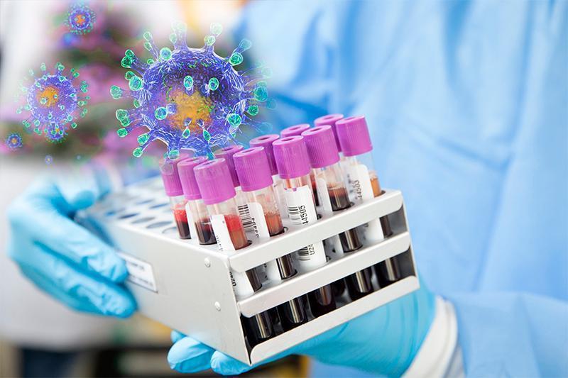 وتكەن تاۋلىكتە قازاقستاندا 1953 ادامنان كوروناۆيرۋس انىقتالدى