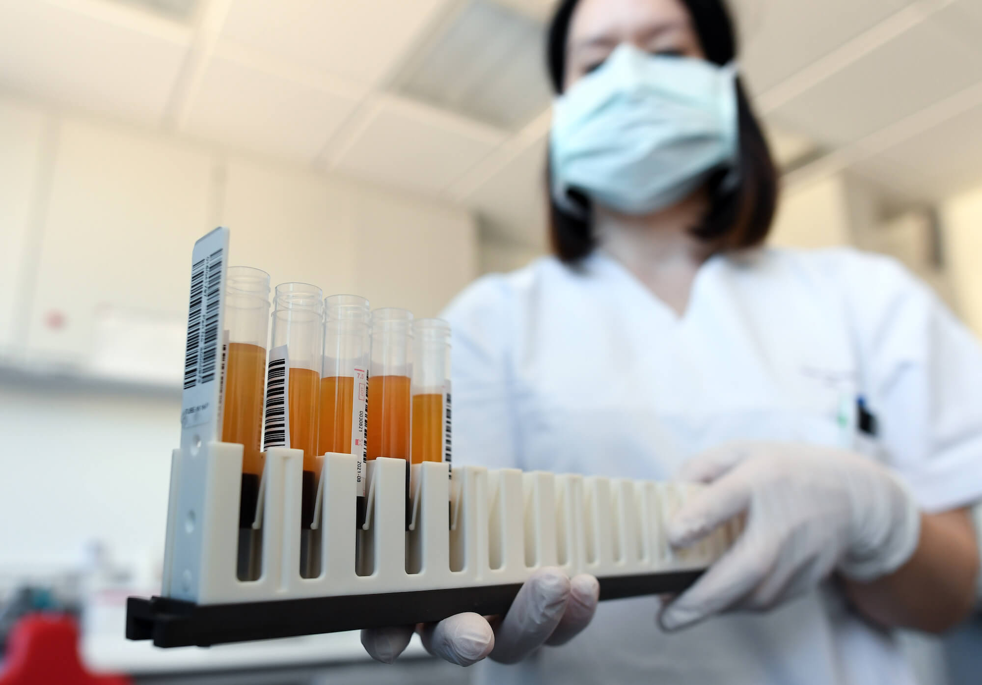 قازاقستاندا وتكەن تاۋلىكتە 795 ادامنان كوروناۆيرۋس انىقتالدى