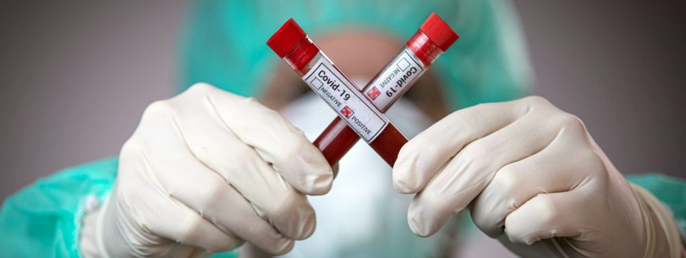 ىندەتپەن كۇرەستە ىركىلىس بولمادى