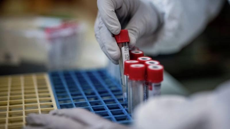 وتكەن تاۋلىكتە 3231 ادامنان كوروناۆيرۋس انىقتالدى