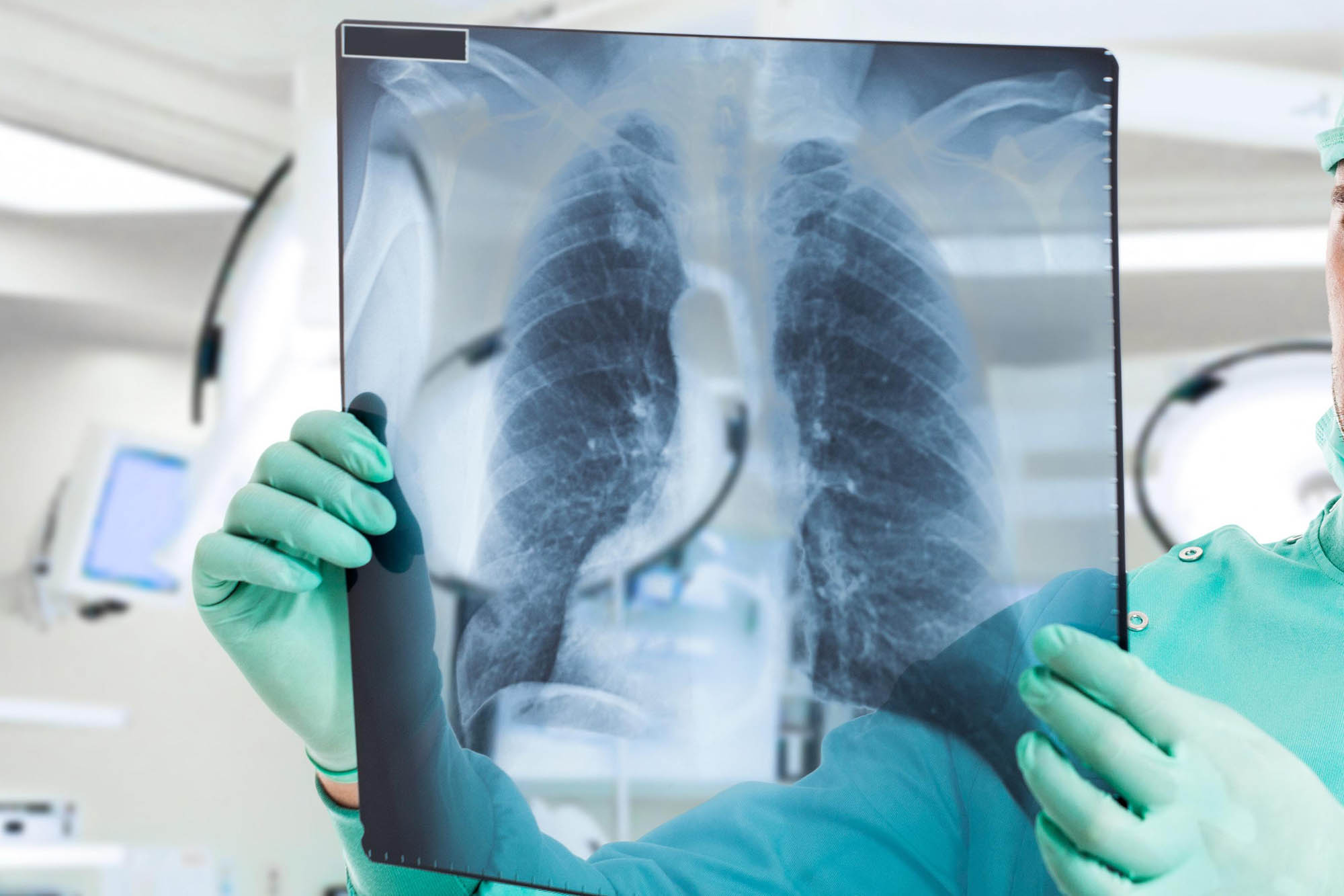 كوروناۆيرۋس پنەۆمونياسى: 29 ادام دەرتىنە داۋا تاپتى