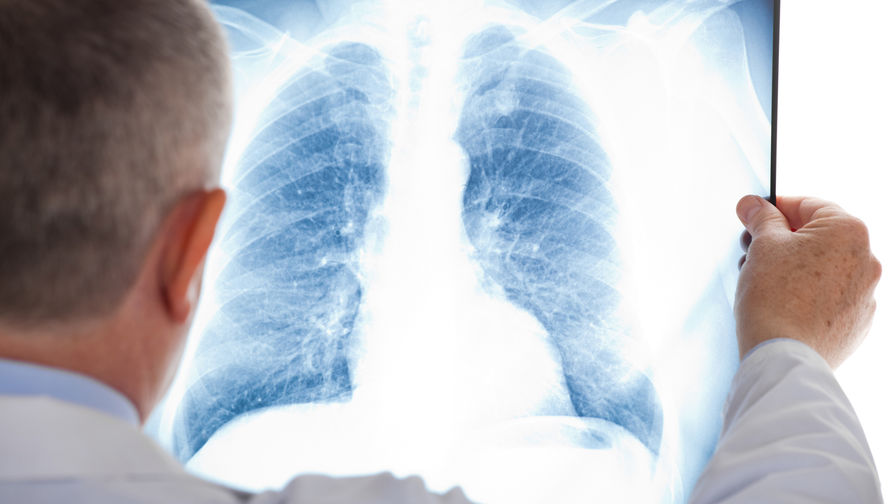 توعىز ازامات كوروناۆيرۋس پنەۆمونياسىن جۇقتىرعان