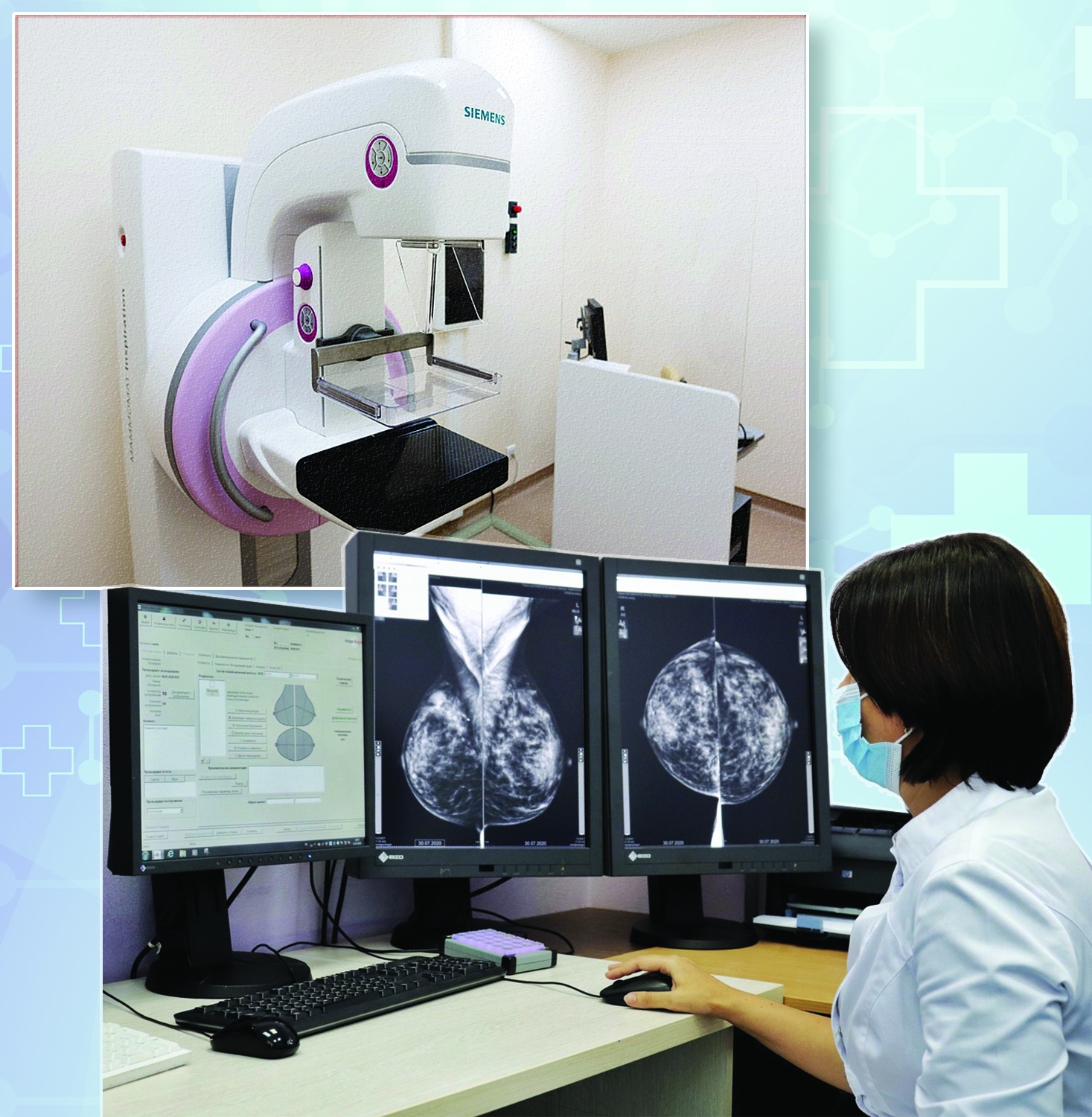 مامموگرافياعا ءمان بەرەتىن كەز كەلدى