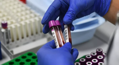 جاپونيادا كوروناۆيرۋستىڭ جاڭا شتاممى انىقتالدى