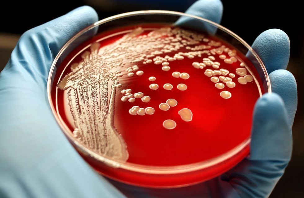 تۇركىستان وبلىسىنىڭ ەكى تۇرعىنىندا ءسىبىر جاراسى انىقتالدى