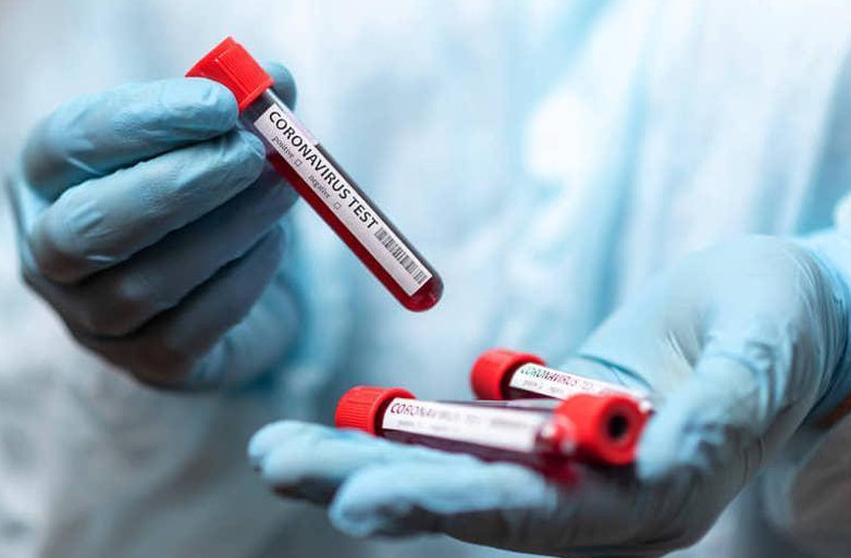 ەلىمىزدە كوروناۆيرۋس جۇقتىرعانداردىڭ سانى ارتتى