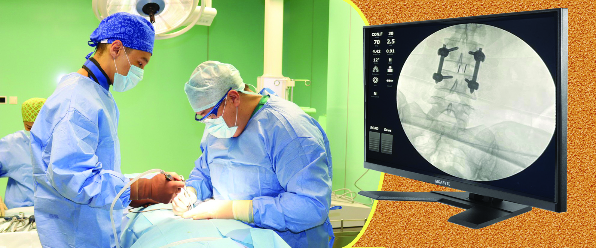 ومىرتقاعا جاسالعان وپەراتسيالار