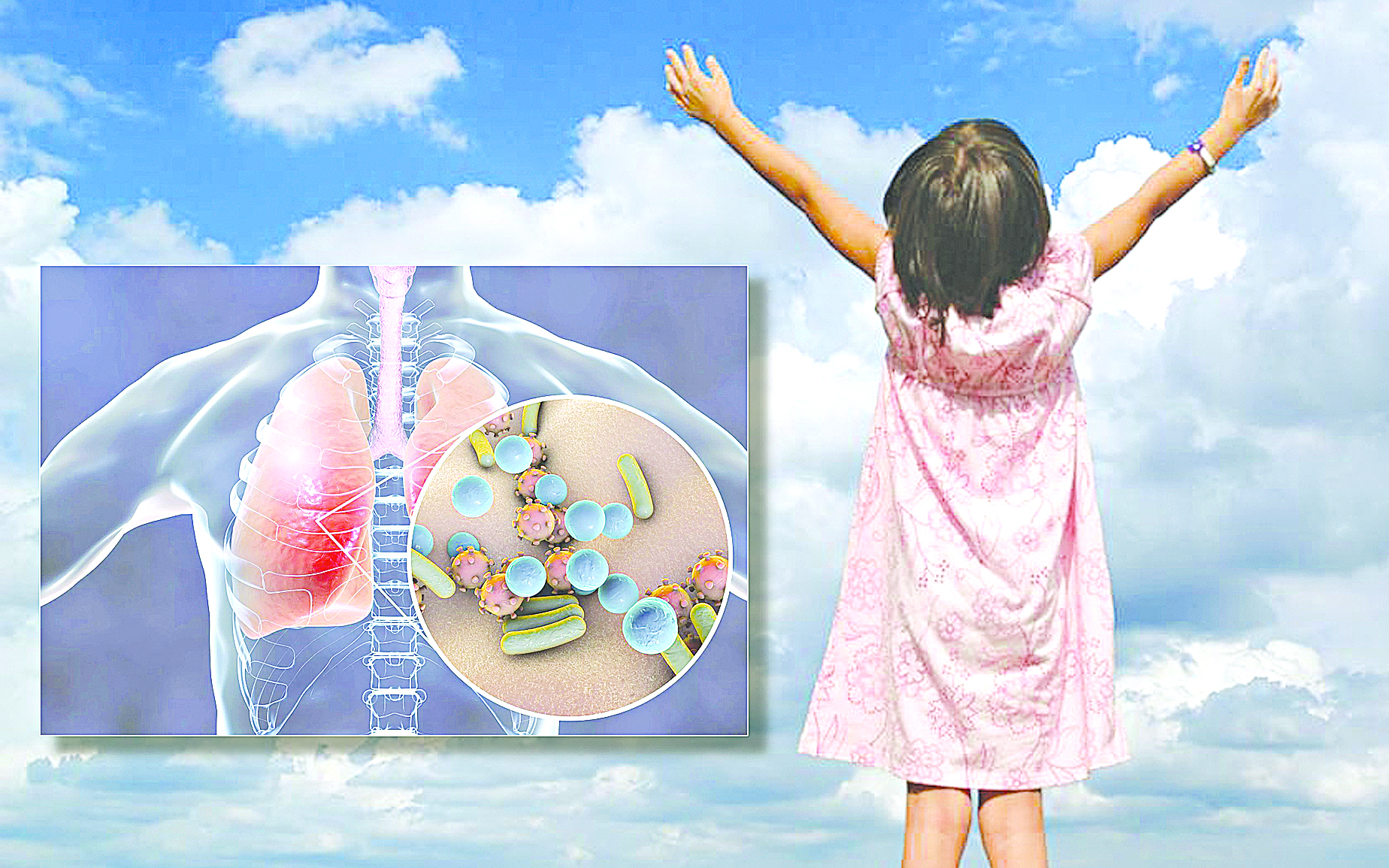 باكتەريالى پنەۆمونياعا شالدىققان بالالار كوپ