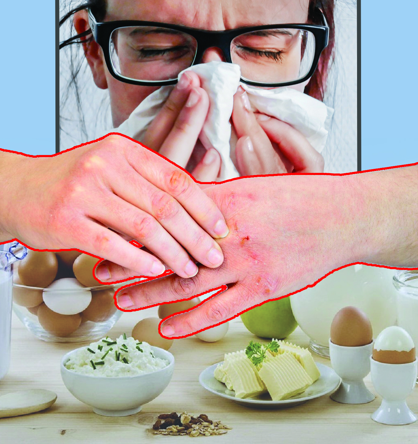 اللەرگيالىق اۋرۋلاردى اسقىندىرىپ الماڭىز!