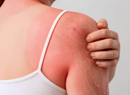 كۇن ساۋلەسى ادام تەرىسىنە تەرىس اسەر ەتەدى - عالىمدار