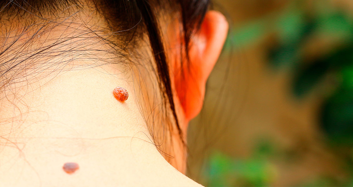 قال استىنداعى قاتەر