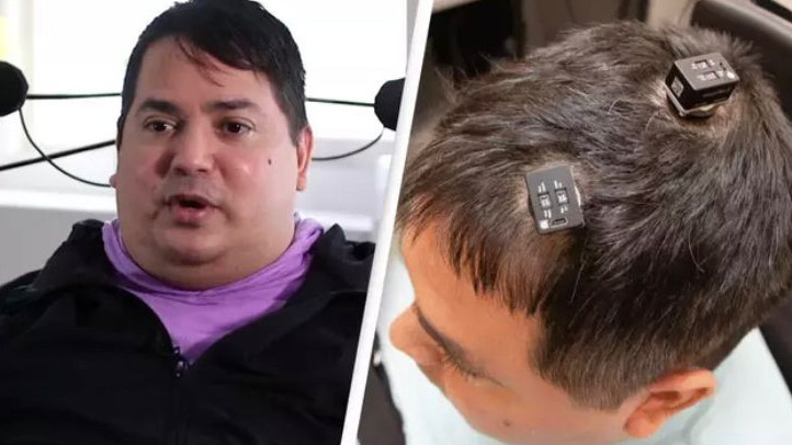 مي يمپلانتاتى سال اۋرۋىنا شالدىققان ادامنىڭ قوزعالۋىنا مۇمكىندىك بەردى