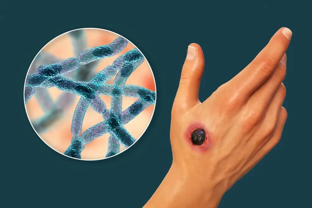 توپالاڭ شوشىتىپ تۇر