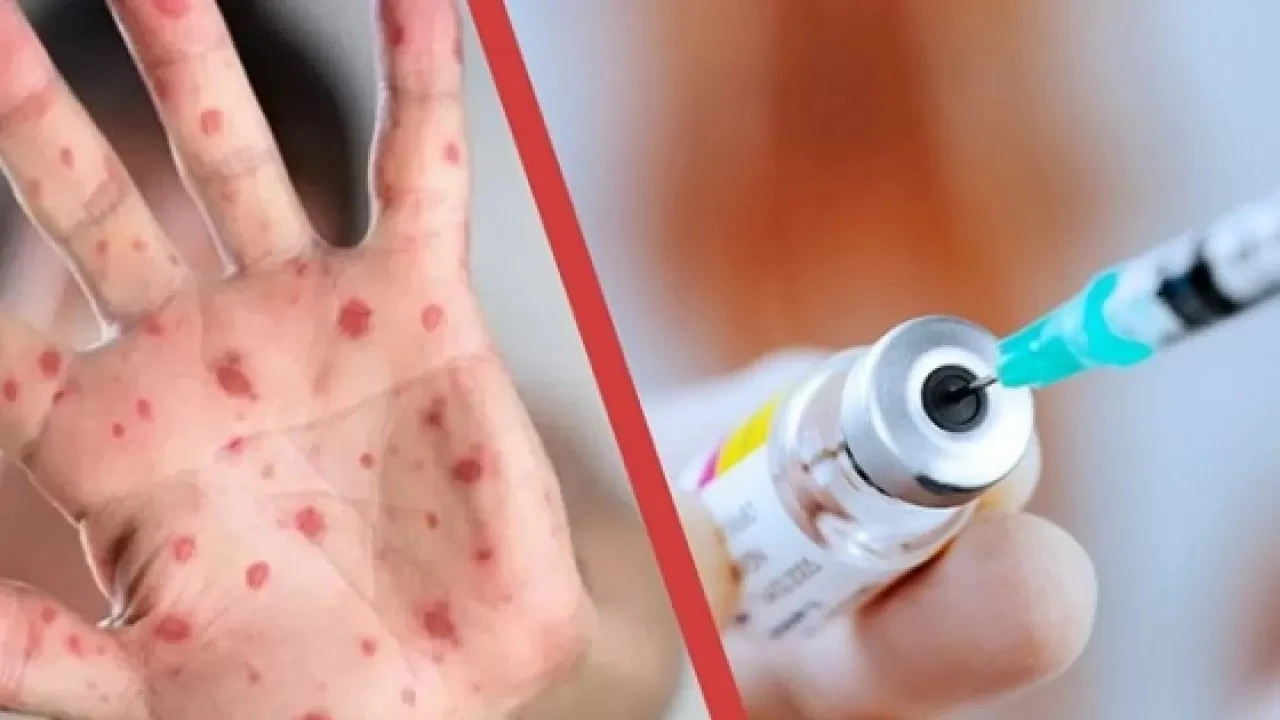 قىزىلشانى ۇجىمدىق يممۋنيتەت جەڭەدى