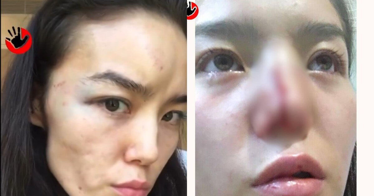 قازاقستاننىڭ ءباا-دەگى ديپلوماتى ايەلىن 10 جىل بويى ازاپتاعانى راس پا؟