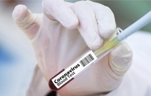 ەلدەگى كوروناۆيرۋس بويىنشا احۋال باقىلاۋدا - مينيسترلىك