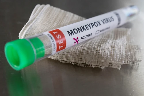 استانا اۋەجايىندا جولاۋشىدان مايمىل شەشەگى انىقتالعانى راس پا