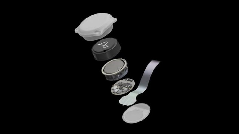 عالام عاجاپتارى: مي يمپلانتى