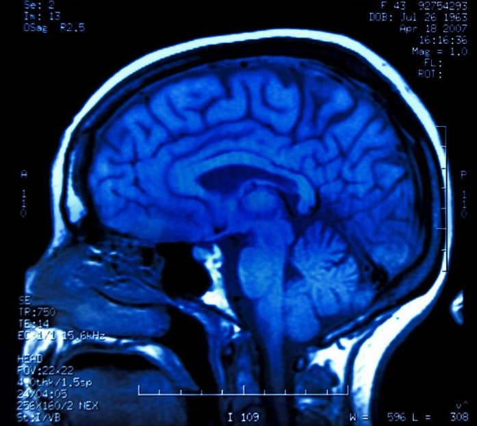 عالام عاجاپتارى: ميدىڭ جاڭا قاباتى