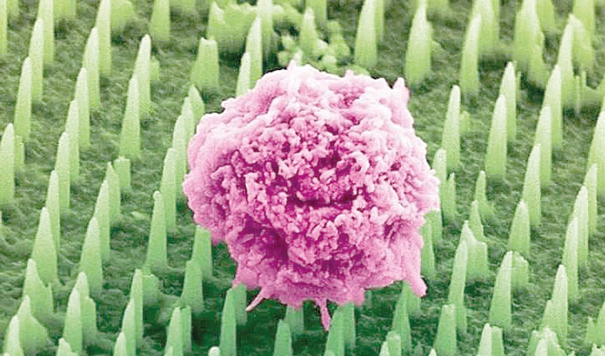 اۋىرتپايتىن امال