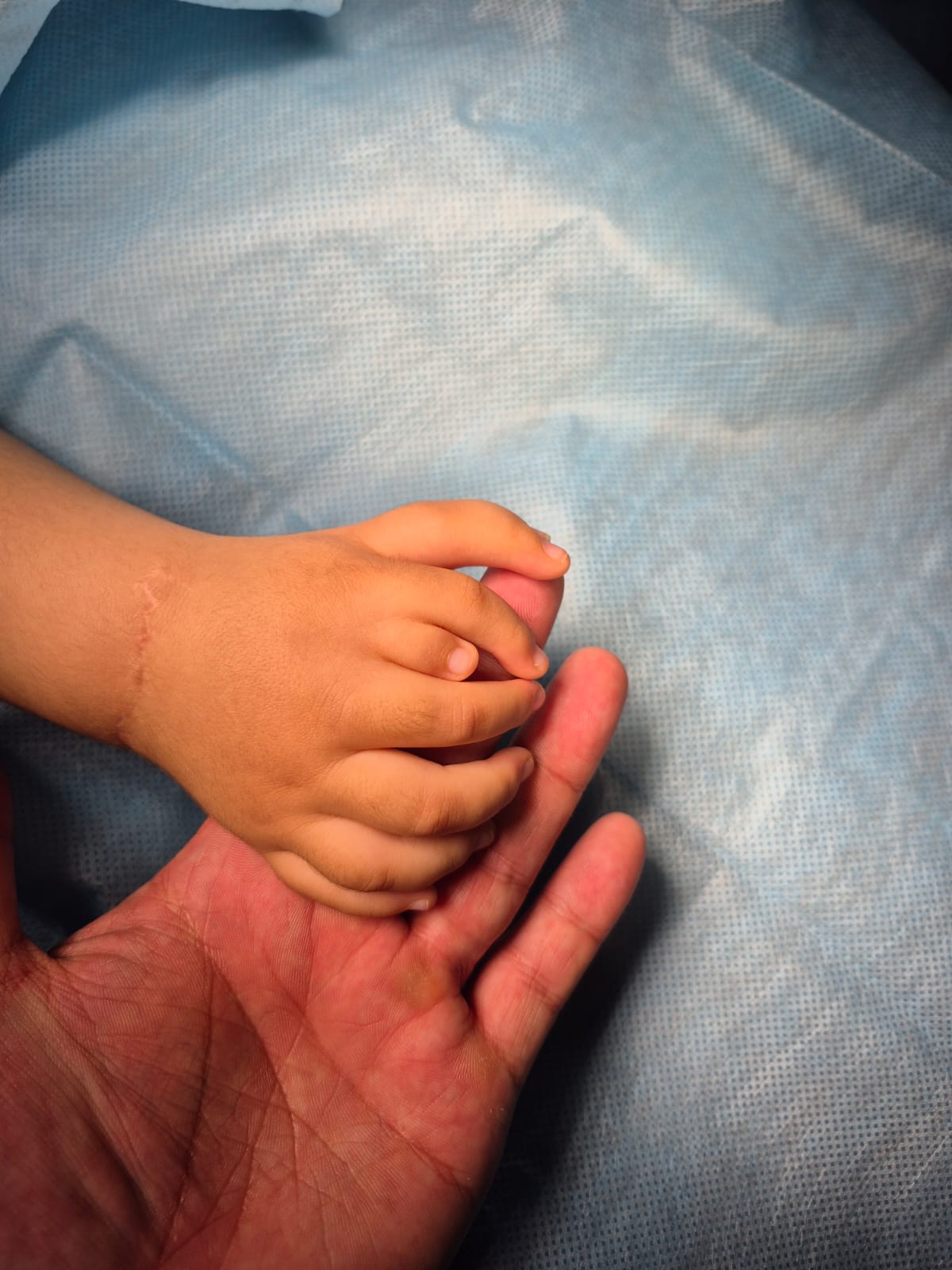 الماتىدا 8 ساۋساقپەن تۋعان بالاعا وتا جاسالدى