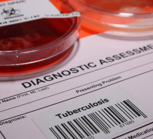 تۋبەركۋلەز كەزىندە كوح تاياقشالارىن 2 ساعاتتا انىقتاۋعا بولادى