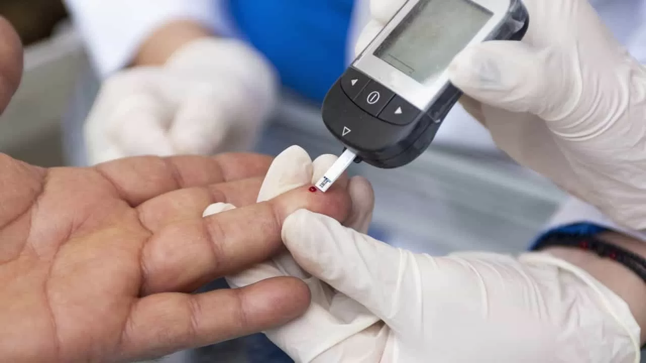 الەۋمەتتىك ءمانى بار سىرقات تۇرلەرىنىڭ تىزبەسى جاڭارادى