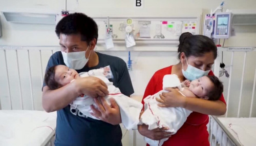 پەرۋ دارىگەرلەرى سيام ەگىزدەرىن اجىراتتى