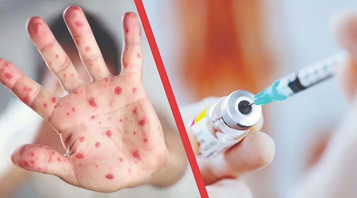 ەلىمىزدە قىزىلشاعا قارسى ۆاكتسيناتسيا ناۋقانى توقتادى ما؟