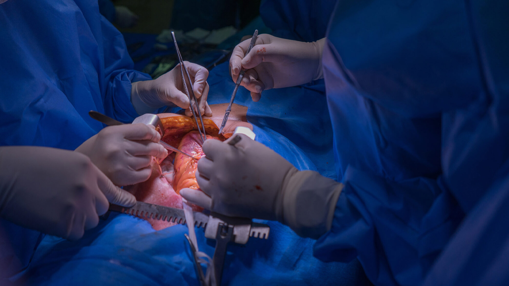 ەلىمىزدە العاش رەت 15 جاستاعى بالاعا جۇرەك ترانسپلانتاتسياسى جاسالدى