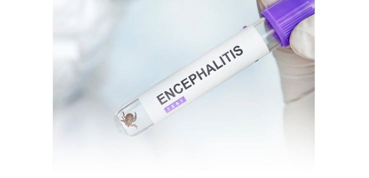 كەنە ەنتسەفاليتىنەن قالاي قورعانۋ كەرەك؟